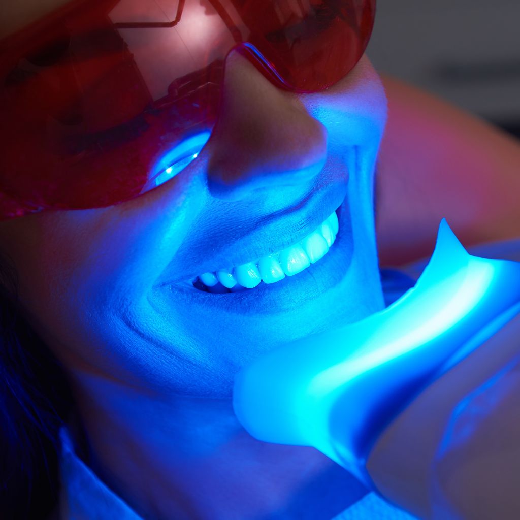 teeth whitening